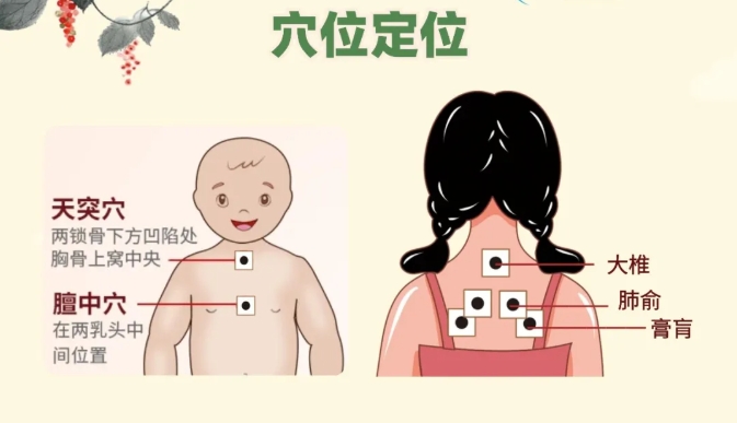 借“天火”养娃，海淀妇幼中医科冬病夏治“三大秘密武器”已备——